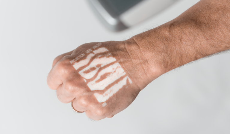 Vein Illumination