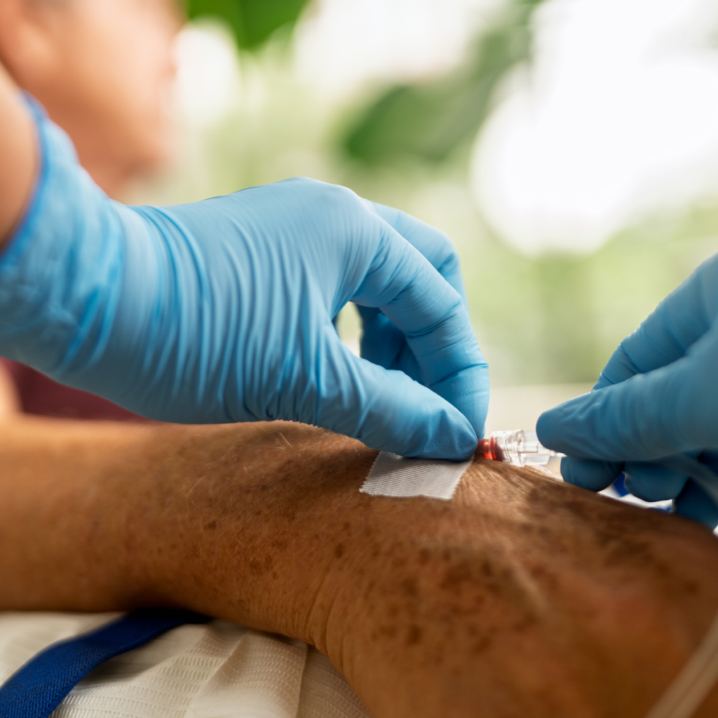 Access to Infusion